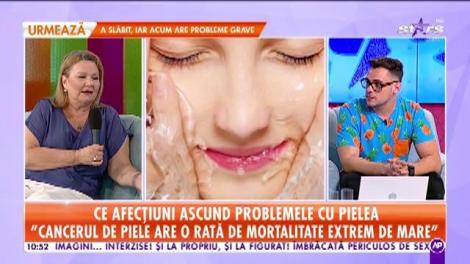 Star Matinal. Cauze care duc la apariția problemelor cu pielea. Medicul dermatolog ne dă cele mai bune sfaturi: Nu puneți iaurt sau oțet pe arsurile solare