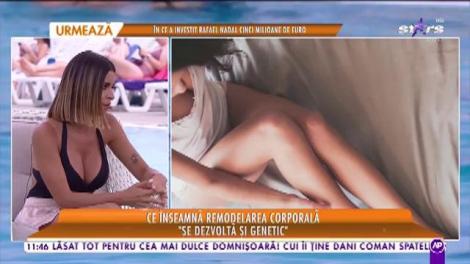 Star Matinal. Ce înseamnă remodelarea corporală! Specialistul ne spune care este metoda eficientă care ne scapă de celulită
