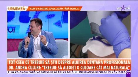 Tot ce trebuie să știi despre albirea dentară profesională