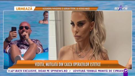 Star Matinal e pe val! Vedetă de peste Ocean, mutilată din cauza operațiilor estetice