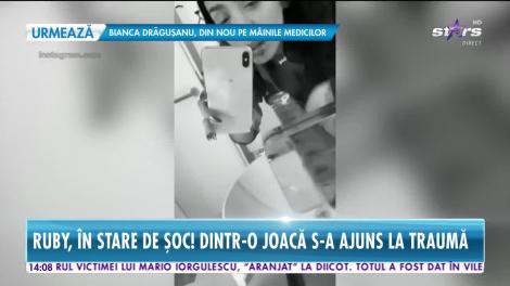 Imagini şocante! Iubitoare de animale, Ruby, a fost muşcată chiar de propriul său câine