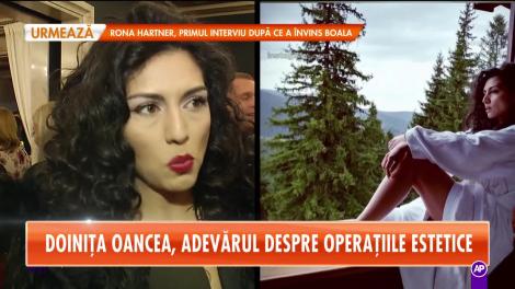 Star Matinal. Doinița Oancea, adevărul despre operațiile estetice