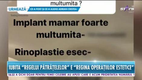 Star News. Inventarul operațiilor estetice ale iubitei lui Dorian Popa