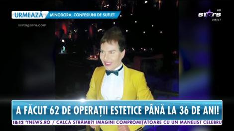 Star News. Păpușa Ken a devenit Barbie! Brazilianul a făcut 62 de operații estetice până la 36 de ani