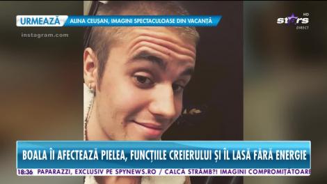 Star News. Justin Bieber se luptă cu o maladie incurabilă. Boala îi afectează funcțiile creierului!