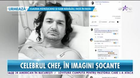 Chef Florin Dumitrescu a ajuns pe mâinile medicilor. Informaţii şi imagini de pe patul de spital!