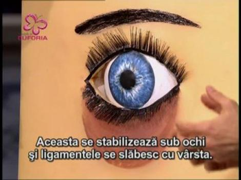 Cum sa  scapi de cearcane