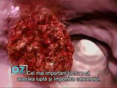 Dr. Oz: Merisoarele sunt mai bune decat afinele