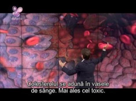 Scade colesterolul fara medicamente