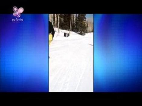 4 metode de a scapa de: pielea flasca si colacei