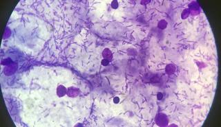 Flora vaginală și fertilitatea. Cum să „hrănești” bacteriile bune care îți cresc șansele de a rămâne gravidă