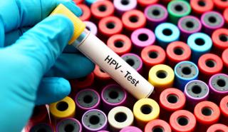 Ce înseamnă un rezultat HPV modificat? Ghid pentru paciente