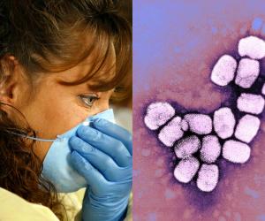 Zeci de cazuri suspecte de infectare la om cu variola maimuței. Care sunt simptomele raportate în micile focare din Europa