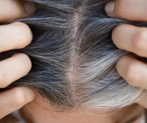 Ce înseamnă dacă ai fire albe de păr și care sunt cauzele. Semnul ce te trimite imediat la medic